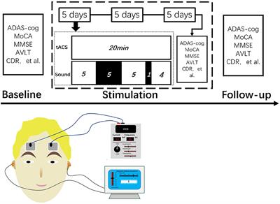 Transcranial alternating current stimulation combined with sound stimulation improves the cognitive function of patients with Alzheimer's disease: A case report and literature review